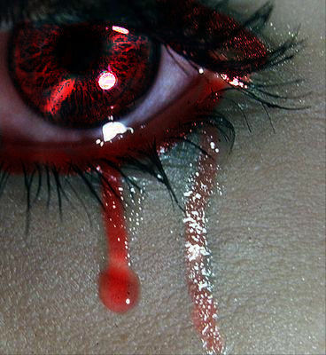 Augen GB Pics - Gästebuch Bilder - weinende-rote-augen.jpg Augen GB Pics - Gästebuch Bilder - weinende-rote-augen.jpg